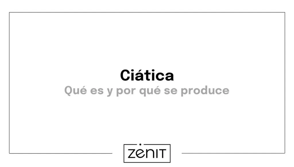 ciática qué es
